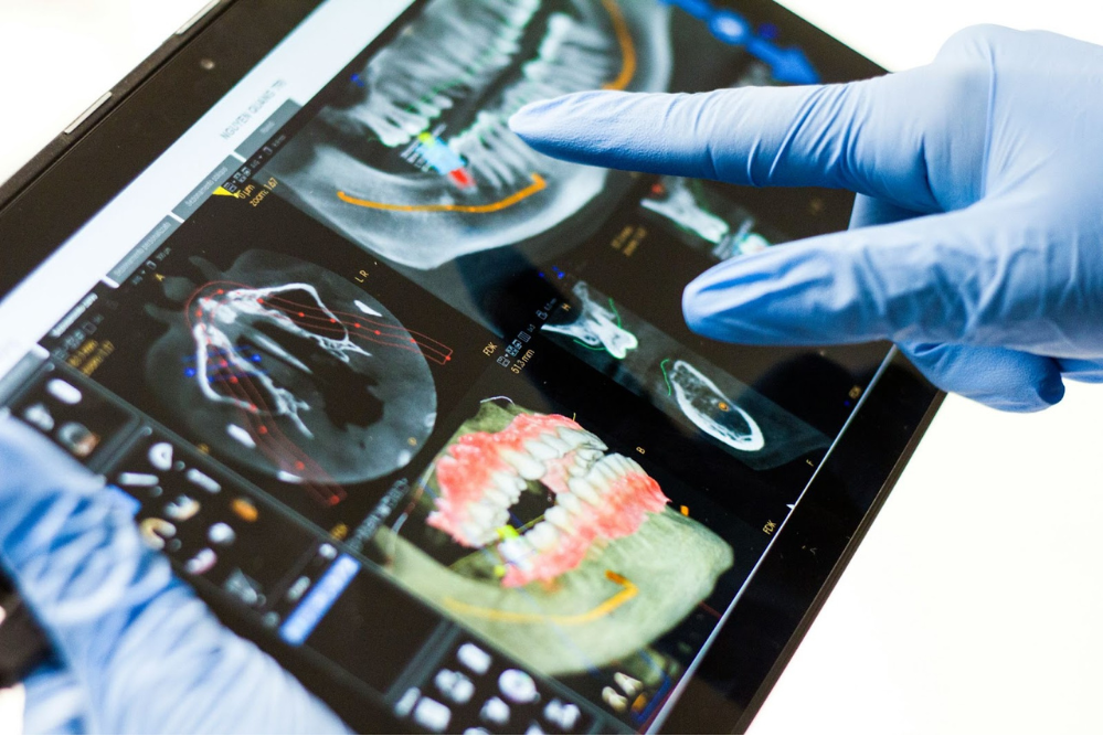 AI’s Potential in Helping Clinicians Identify Dental Implants